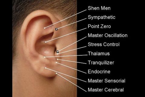 ear-seed-placement